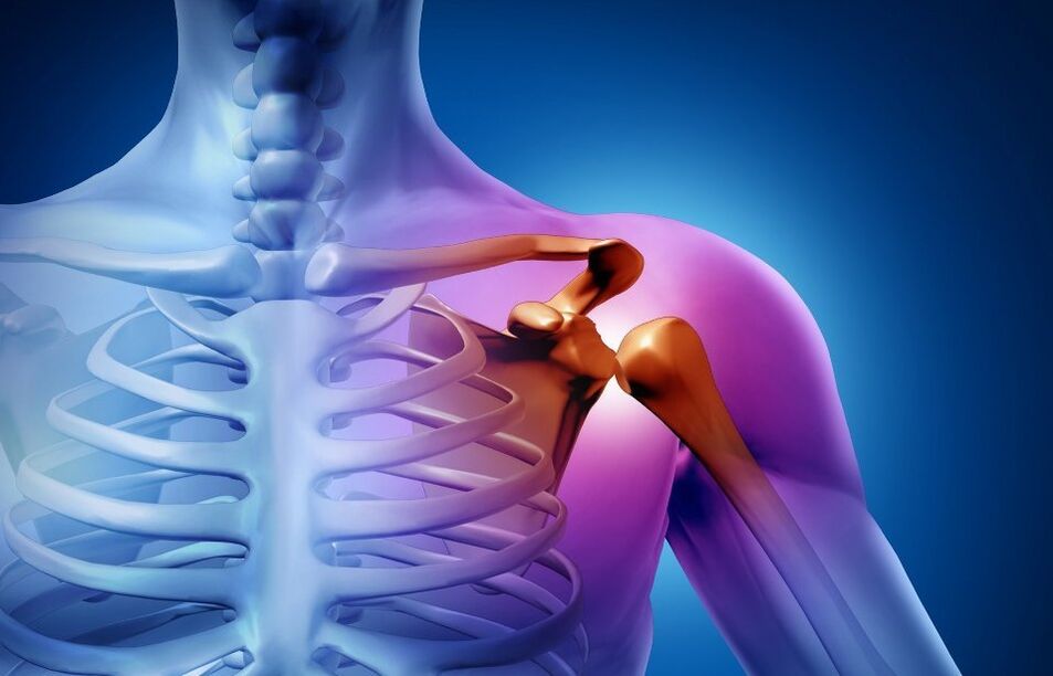 Травмы плеча, вызванные артропатией
