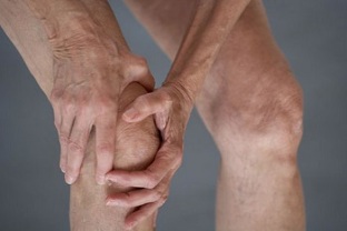 Признаки и симптомы артрита коленного сустава